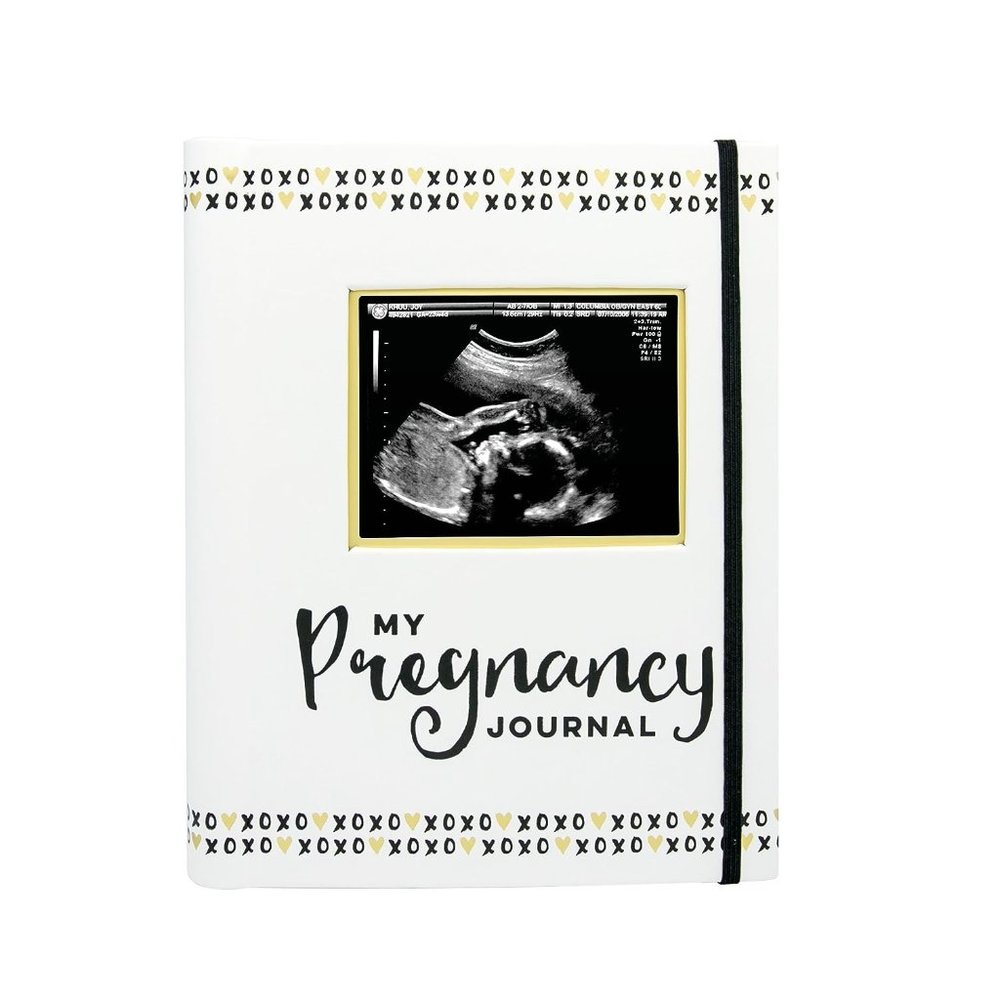 Pearhead My Pregnancy Journal, Newborn Milestone Keepsake Memory Book, Photo Alb